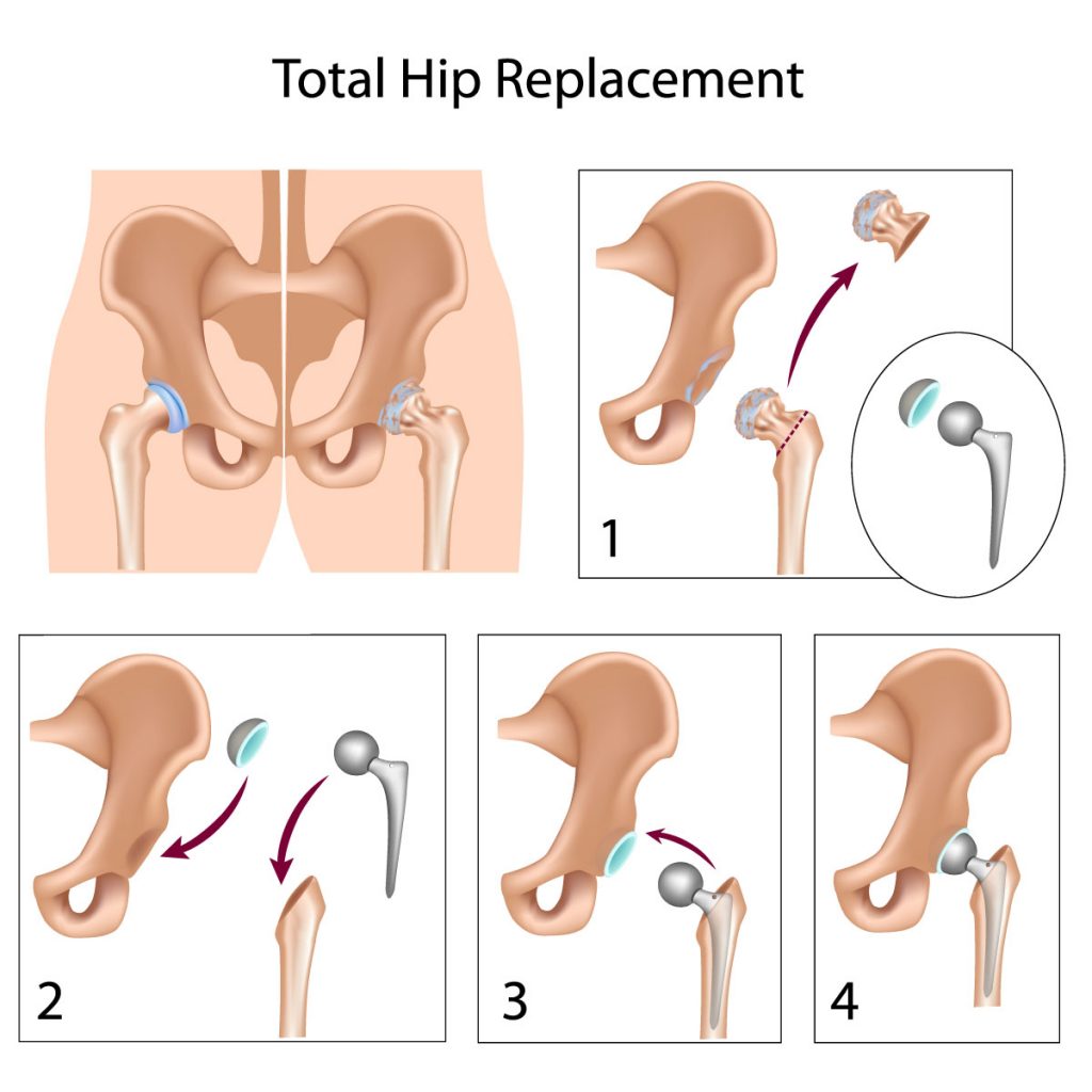 New Orleans orthopedic surgeons