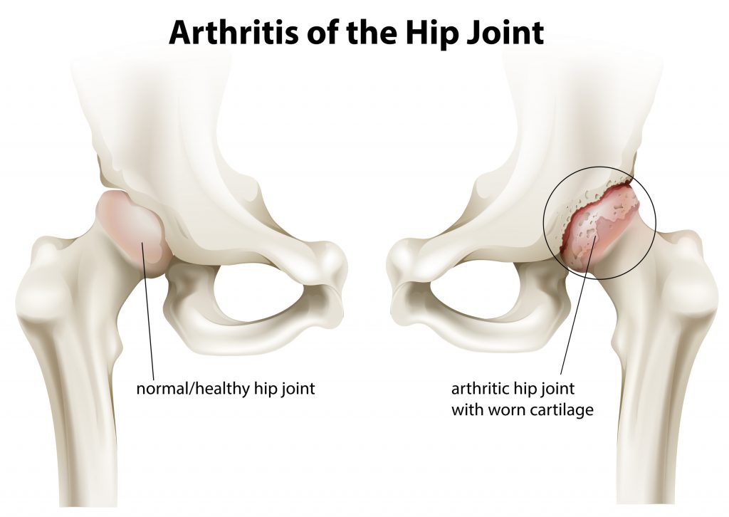 New Orleans orthopedic surgeon